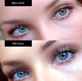 lilash-before-after__77677-1